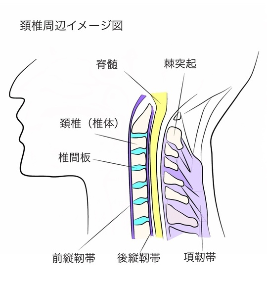 ヘルニア 頚椎椎間板ヘルニアの基礎知識